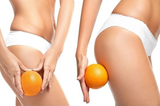 narancsbőr elleni krém